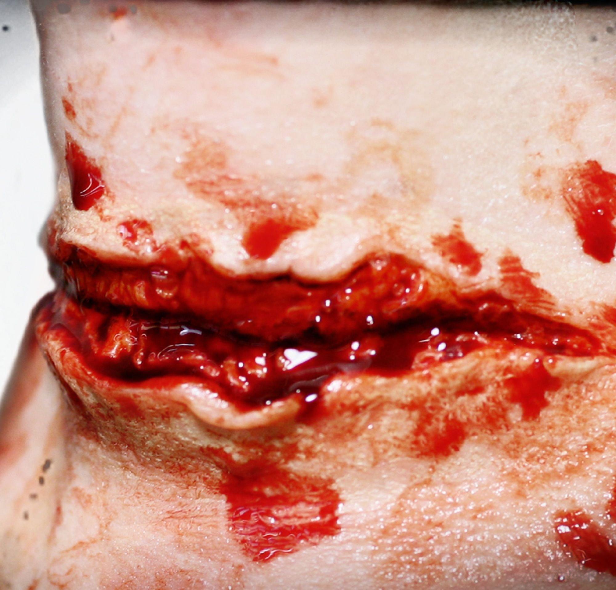 Cut Throat Prosthetics- Tinsley Transfers