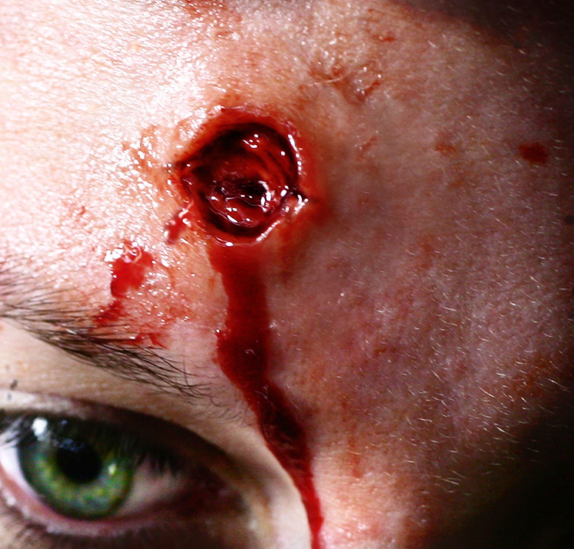 Capped Bullet Wound Prosthetics- Tinsley Transfers