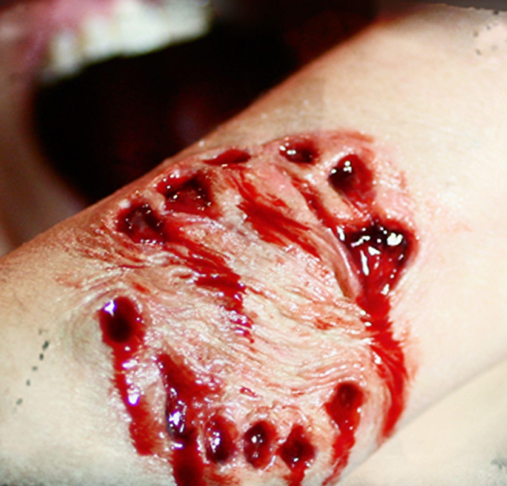 Vampire Bite Wound Prosthetic- Tinsley Transfers